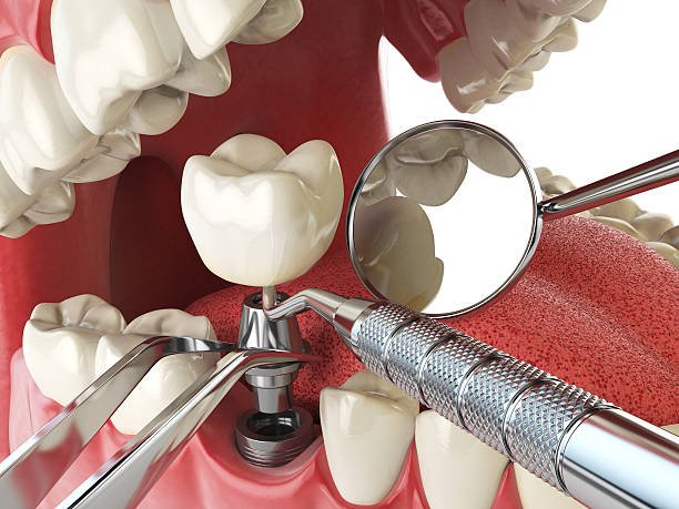 Best Emergency Cosmetic Dentistry in Lockport, LA
